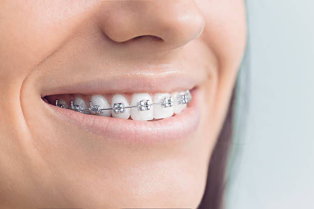 Best TMJ/TMD Treatment  in Fish Hawk, FL